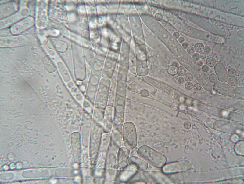 Saccharomyces Boulardii: The Yeast Probiotic Gaining Ground