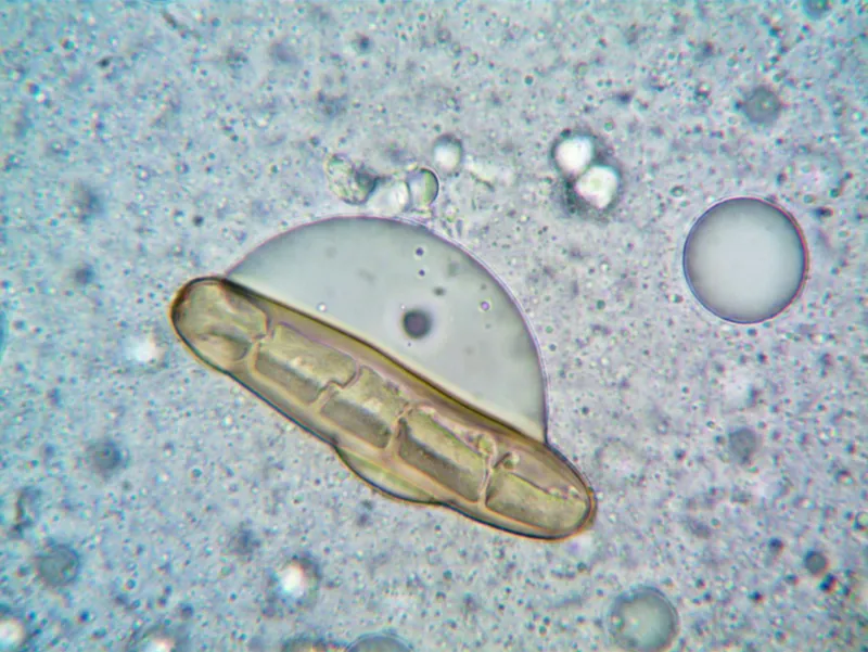 Beta-Glucans: Fibre for Cholesterol and Immune System Support